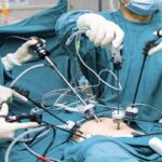 What is Laparoscopic Surgery Benefits & Procedure Explained - Dr. Nainesh Patel